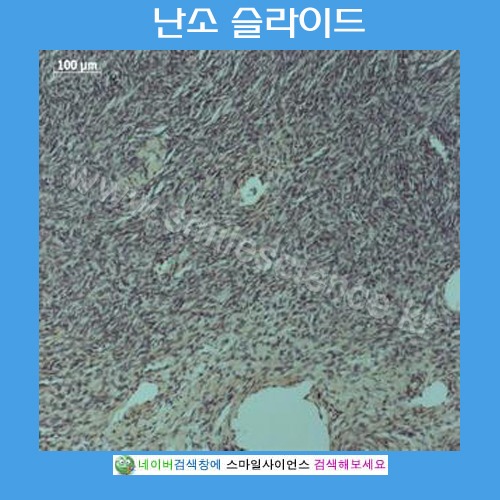 난소 슬라이드(현미경용프레파라트)
