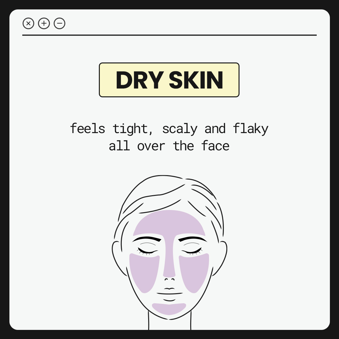 Dry Skin