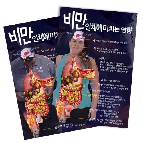 비만 교육용 판넬 차트