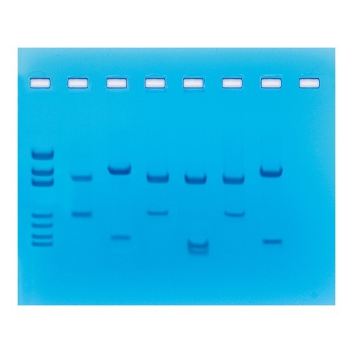 제한효소에 의한 DNA 지문분석