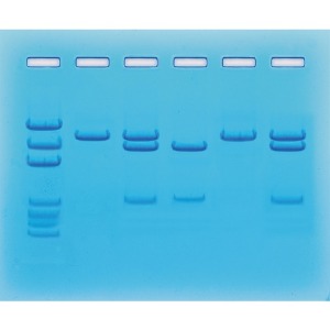 코로나바이러스 핵산검사 실험키트(COVID-19)