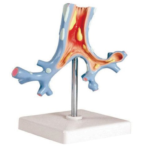인체 호흡기(기관지)모형