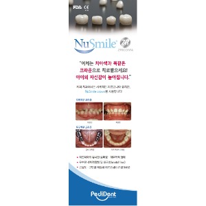 NuSmile Crown 배너